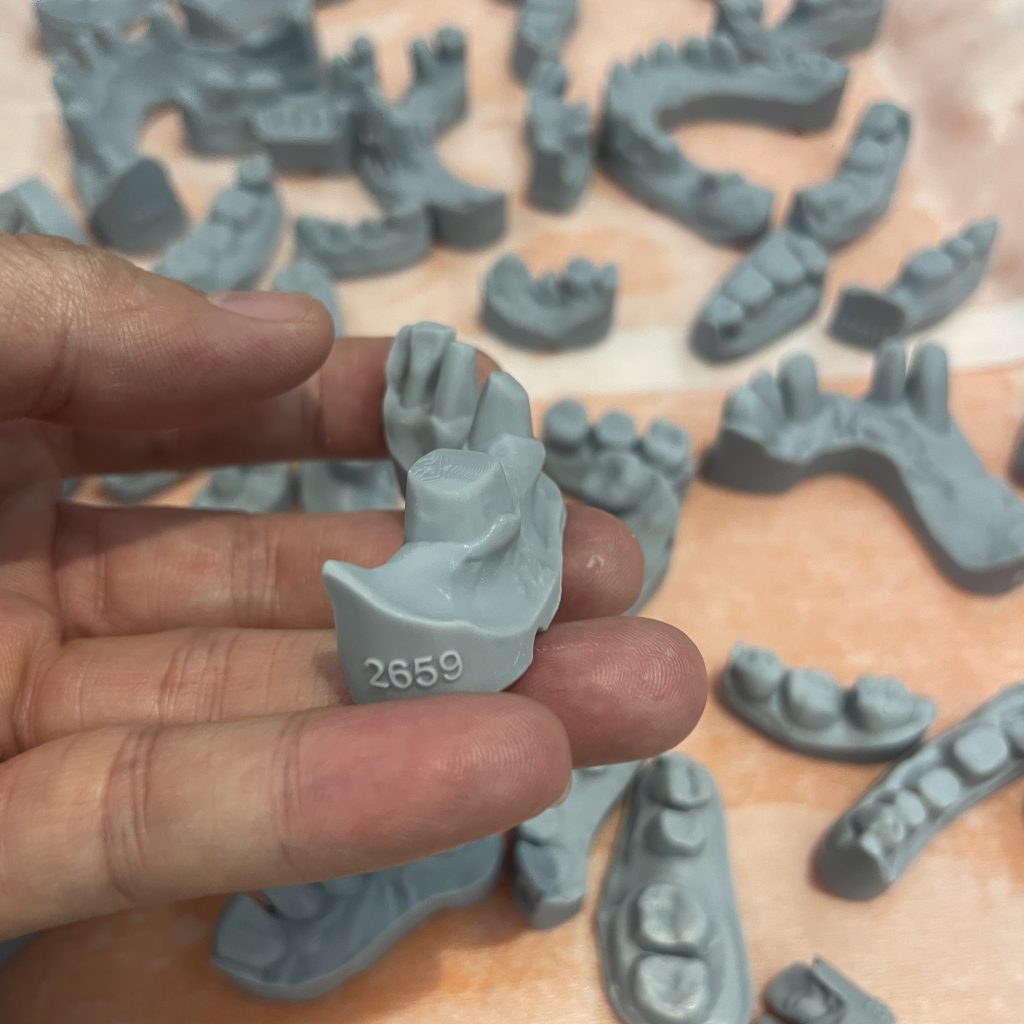 althon dental resin model